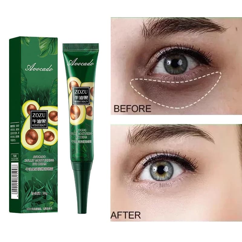 Creme instantâneo anti-rugas para os olhos, anti-olheiras, bolsas nos olhos e produtos para o cuidado da pele com inchaç
