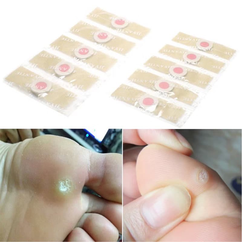 Adesivos Removedor De Calos Olho De Peixe Kit 5/10/20/30/40